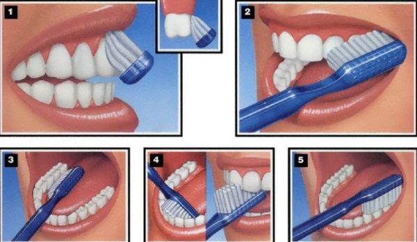 Cách vệ sinh răng miệng đúng cách mà mọi người nên áp dụng