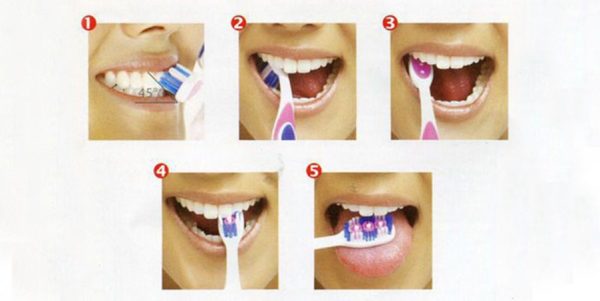 Cách đánh răng đúng cách để mọi người tham khảo 